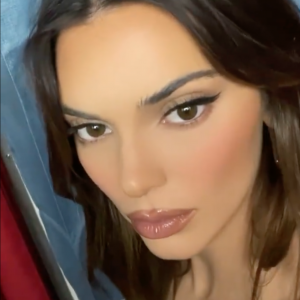Quelque chose a changé sur le visage de Kendall Jenner. Le top model fait l'objet de soupçons sur une opération de chirurgie esthétique...