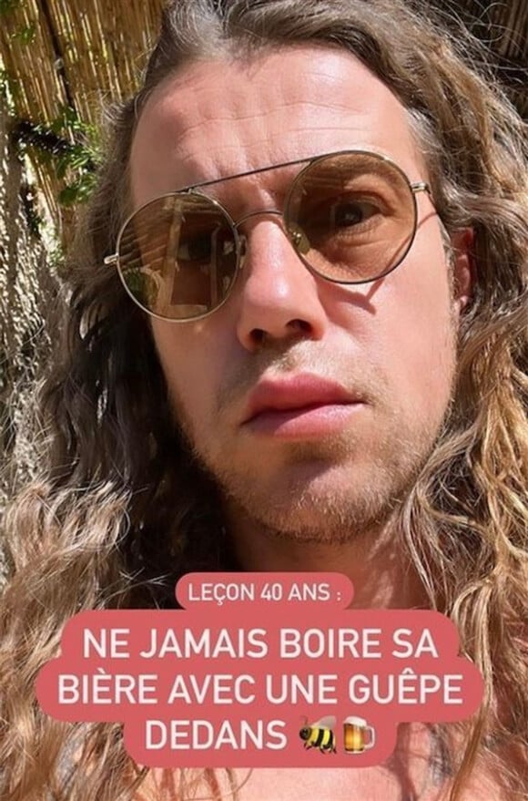 Julien Doré dévoile sa bouche XXL sur Instagram