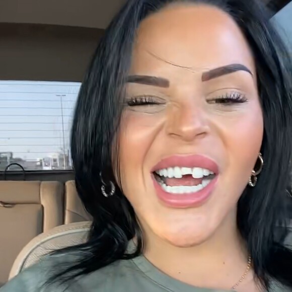 Sarah Fraisou se dévoile avec une dent cassée sur Snapchat, le 9 novembre 2022
