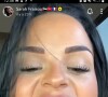 Sarah Fraisou se dévoile avec une dent cassée sur Snapchat, le 9 novembre 2022