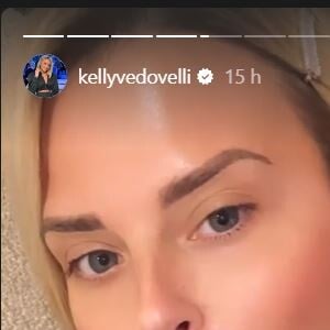 Kelly Vedovelli dévoile sa boule dans le cou