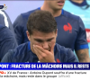 Images chocs et nouvelles d'Antoine Dupont après sa blessure contre la Namibie, "BFMTV".