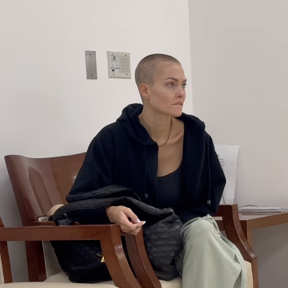 Caroline Receveur atteinte d'un cancer, se dévoile le crâne rasé sur les réseaux sociaux. Instagram