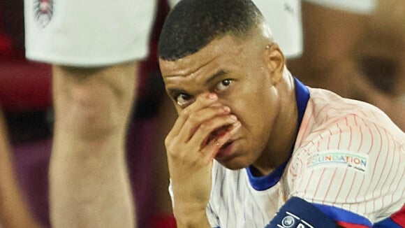 "Le problème, c'est surtout..." : Kylian Mbappé obligé de porter un masque après sa blessure, un sacré défi pour la suite de l'Euro