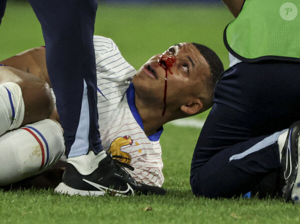 Kylian Mbappé a été victime d'une fracture du nez lors du du match du groupe D de l'Euro 2024 entre l'équipe de France face à l'Autriche (1-0) à Dusseldorf en Allemagne le 17 jun 2024. Sorti avec le nez cassé après un choc avec Kevin Danso, Kylian Mbappé a passé des premiers examens qui laissent place à l'optimisme. L'intervention chirurgicale est écartée « dans l'immédiat », selon la FFF. © Cyril Moreau/Bestimage