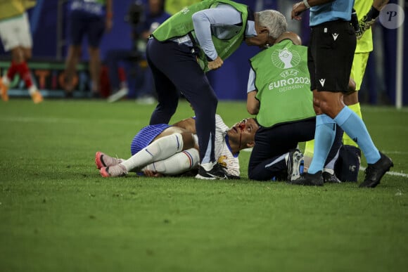 Kylian Mbappé est forfait vendredi pour la rencontre face aux Pays-Bas.
Kylian Mbappé a été victime d'une fracture du nez lors du match du groupe D de l'Euro 2024 entre l'équipe de France et l'Autriche (1-0) à Dusseldorf en Allemagne le 17 jun 2024. Sorti avec le nez cassé après un choc avec Kevin Danso, Kylian Mbappé a passé des premiers examens qui laissent place à l'optimisme. L'intervention chirurgicale est écartée " dans l'immédiat ", selon la FFF. 