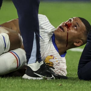 Suite à sa blessure au nez contre l'Autriche hier soir.
Kylian Mbappé a été victime d'une fracture du nez lors du match du groupe D de l'Euro 2024 entre l'équipe de France et l'Autriche (1-0) à Dusseldorf en Allemagne le 17 jun 2024. Sorti avec le nez cassé après un choc avec Kevin Danso, Kylian Mbappé a passé des premiers examens qui laissent place à l'optimisme. L'intervention chirurgicale est écartée " dans l'immédiat ", selon la FFF. 