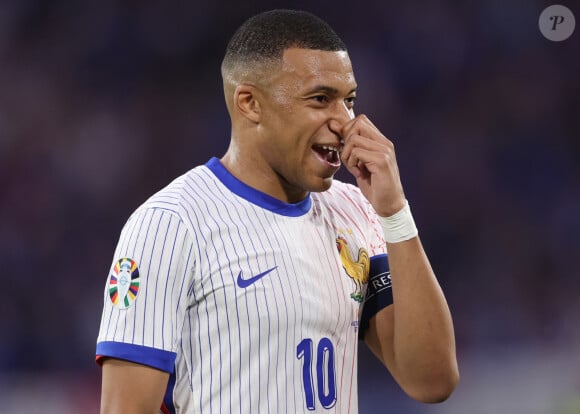 -Kylian Mbappé a été victime d'une fracture du nez lors du match du groupe D de l'Euro 2024 entre l'équipe de France et l'Autriche (1-0) à Dusseldorf en Allemagne le 17 jun 2024. Sorti avec le nez cassé après un choc avec Kevin Danso, Kylian Mbappé a passé des premiers examens qui laissent place à l'optimisme. L'intervention chirurgicale est écartée " dans l'immédiat ", selon la FFF. 