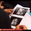 Amélie de Secret Story 4, enceinte, présente les échographies de son bébé devant les caméras de En mode Gossip sur NT1