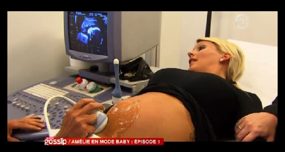 Amélie de Secret Story 4, enceinte, en pleine échographie devant les caméras de En mode Gossip sur NT1