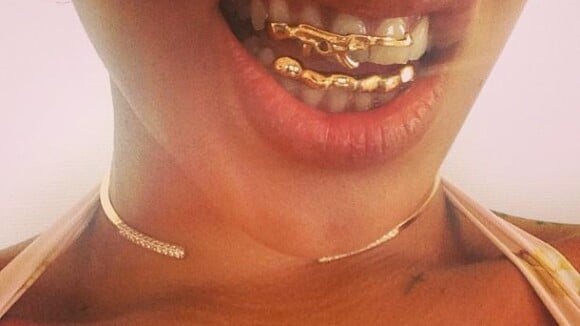 Rihanna : Fière de ses dents en or et attaquée en justice pour impayés