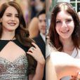 Lana Del Rey est-elle victime de la chirurgie ?