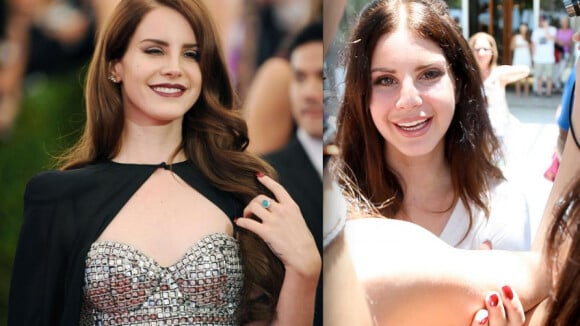 Lana Del Rey : Tirée et bouffie, la jeune star a-t-elle cédé à la chirurgie ?