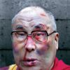 Le Dalaï Lama pour Amnesty International