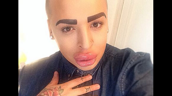 Kim Kardashian : Un fan se ruine en chirurgie pour lui ressembler... Choquant !