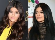 Kylie Jenner a menti : Ses lèvres pulpeuses et la chirurgie, elle avoue tout !