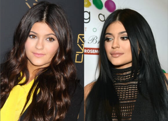 Kylie Jenner en 2012 et en 2015. La star de 17 ans a admis avoir eu recours à des injections pour augmenter le volume de ses lèvres.
