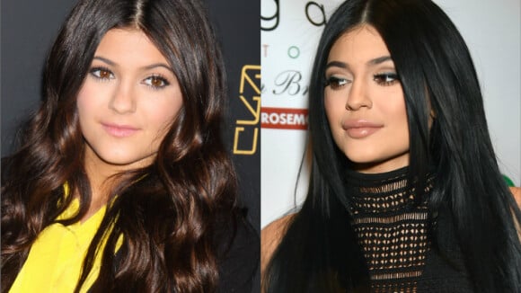 Kylie Jenner a menti : Ses lèvres pulpeuses et la chirurgie, elle avoue tout !