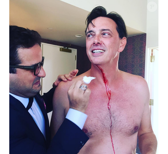 Donovan Leitch s'est coupé juste avant d'épouser Libby Mintz, le 3 octobre 2015 / photo postée sur Instagram
