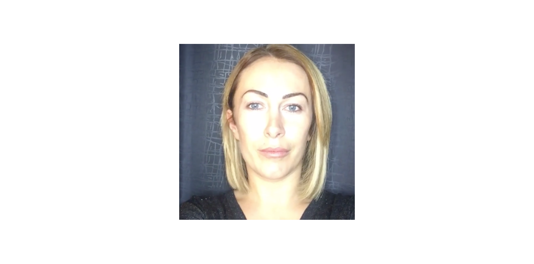 Chirurgie Plastique Demdem Avant Apres Chirurgie Gaëlle (Les Ch'tis) a-t-elle eu recours au botox ? Son selfie fait  scandale... - Purepeople