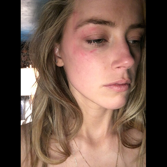 Les photos d'Amber Heard