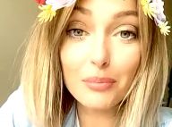 Caroline Receveur révèle comment elle a mis fin à ses problèmes de peau