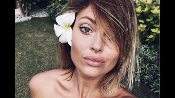 Caroline Receveur "toute en chirurgie" sur Instagram pour répondre aux critiques