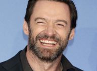 Hugh Jackman amusé : "Peut-être que je suis allé trop loin avec la chirurgie"