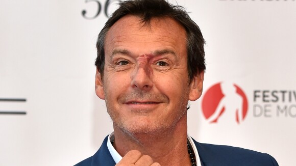 Jean-Luc Reichmann, son enfance avec sa tache sur le nez : "C'était violent"