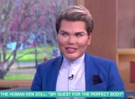 Rodrigo Alves : Le Ken Humain se défend d'être accro à la chirurgie esthétique