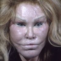 Jocelyn Wildenstein : La femme chat autorisée à revoir son compagnon...