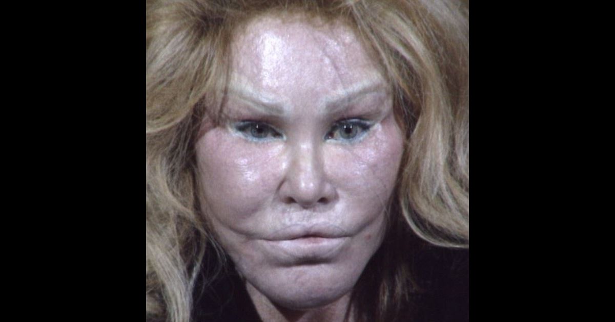 Jocelyn Wildenstein La Femme Chat Autorisee A Revoir Son Compagnon Purepeople