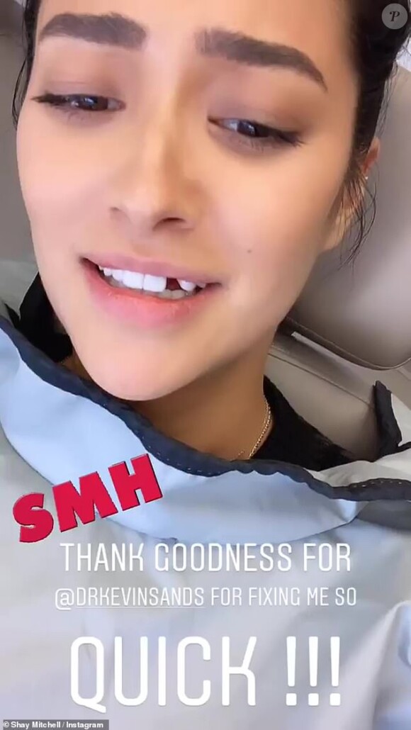 Shay Mitchell perd une dent en mangeant un bagel- Story Instagram, le 18 avril 2019.