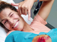 Laury Thilleman hospitalisée : elle dévoile les photos de ses blessures