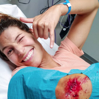 Laury Thilleman hospitalisée : elle dévoile les photos de ses blessures