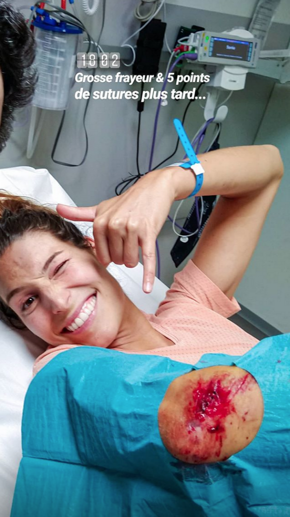 Mardi 13 août 2019, Laury Thilleman a fait une violente chute à vélo. Elle a été hospitalisée et a eu cinq point de suture.