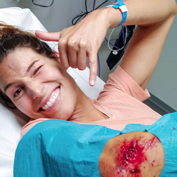 Mardi 13 août 2019, Laury Thilleman a fait une violente chute à vélo. Elle a été hospitalisée et a eu cinq point de suture.