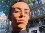 Bilal Hassani, ses nouvelles injections au visage : Il dévoile un avant/après...