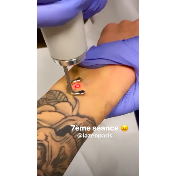 Caroline Receveur se fait enlever son tatouage au laser, sur Instagram le 19 décembre 2019.
