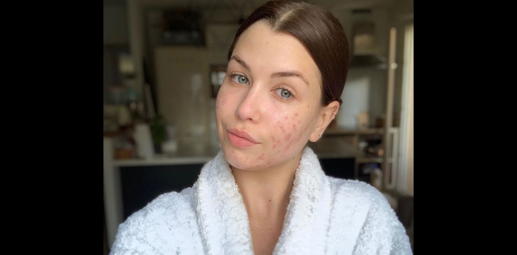 Enjoyphoenix Elle Se Dévoile Sans Maquillage Sans Facetune