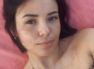 Agathe Auproux : Forte, elle dévoile ses "cheveux tombés" et son cathéter