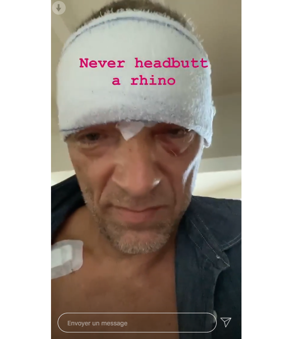 Vincent Cassel dévoile son visage tuméfié sur Instagram, le 22 mai 2020. L'acteur a été victime d'un accident de scooter près de Biarritz, le 20 mai.