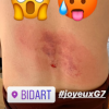 Vincent Cassel blessé sur Instagram, le 24 août 2019.