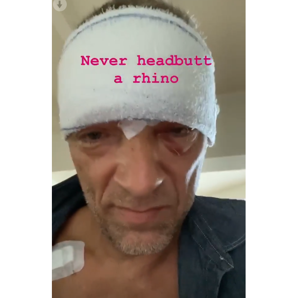 Vincent Cassel dévoile son visage tuméfié sur Instagram, le 22 mai 2020. L'acteur a été victime d'un accident de scooter près de Biarritz, le 20 mai.