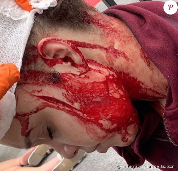 La petite-fille de Joe Jackson, Yasmine, gravement blessée après une agression à l'arme blanche à caractère raciste. Las Vegas, le 30 mai 2020.