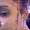 Yasmine Jackson, la nièce de Michael Jackson et fille de sa demi-soeur, Joh'Vonnie Jackson, a été victime d'une agression raciste, à l'arme blanche. Mai 2020.