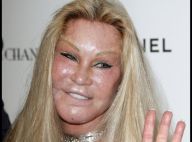 Jocelyn Wildenstein a dépensé 3 millions d'euros en chirurgie esthétique pour... ressembler à un chat ! Incroyable !
