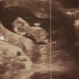 Marion Bartoli est enceinte de son premier enfant. Une annonce faite le 28 mai 2020.