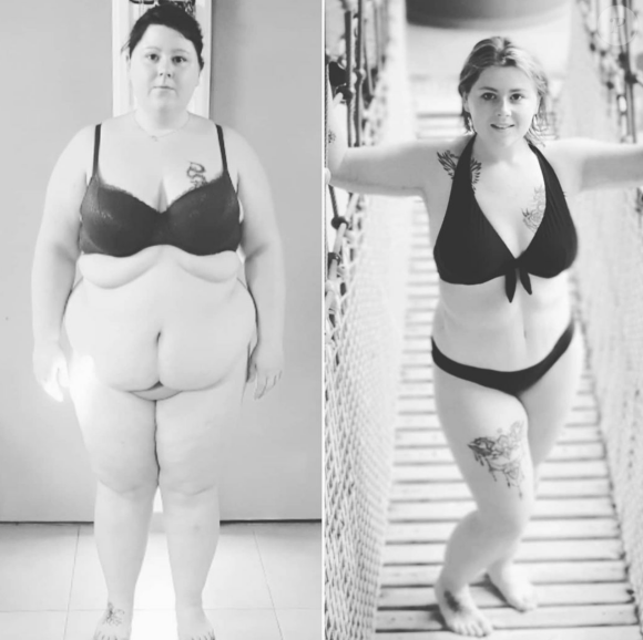 Stacy, participante à l'émission "Opération renaissance" sur M6 qui suit des personnes obèses dans leur transformation physique.