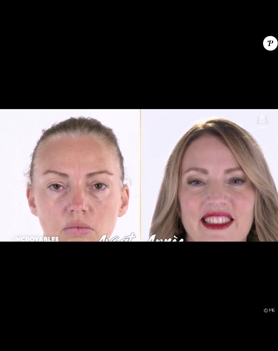 Caroline, ex-Miss, est métamorphosée dans "Incroyables transformations" sur M6.